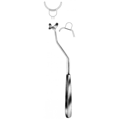 Tonsil